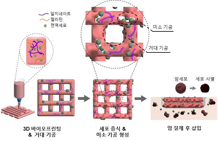 3D Bioprinting in Cancer Treatment